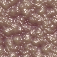 ostealfracture1000x1000-008 ostealfracture1000x1000-008